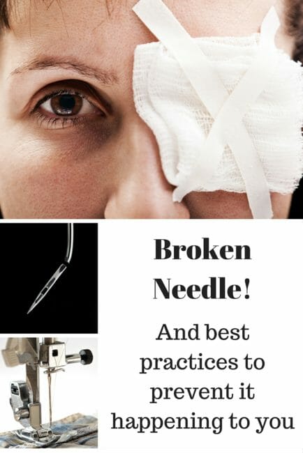 broken needle